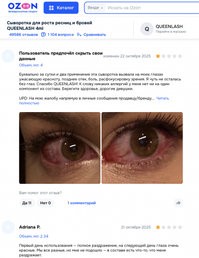 Queenlash отзывы: мифы, реальность и скандалы на рынке сывороток для ресниц